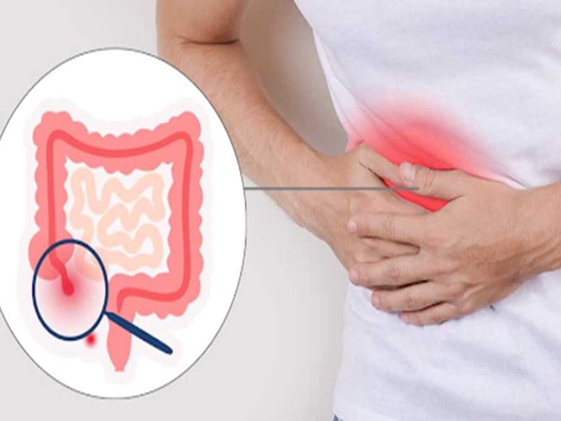 chữa đau bụng đi ngoài buồn nôn