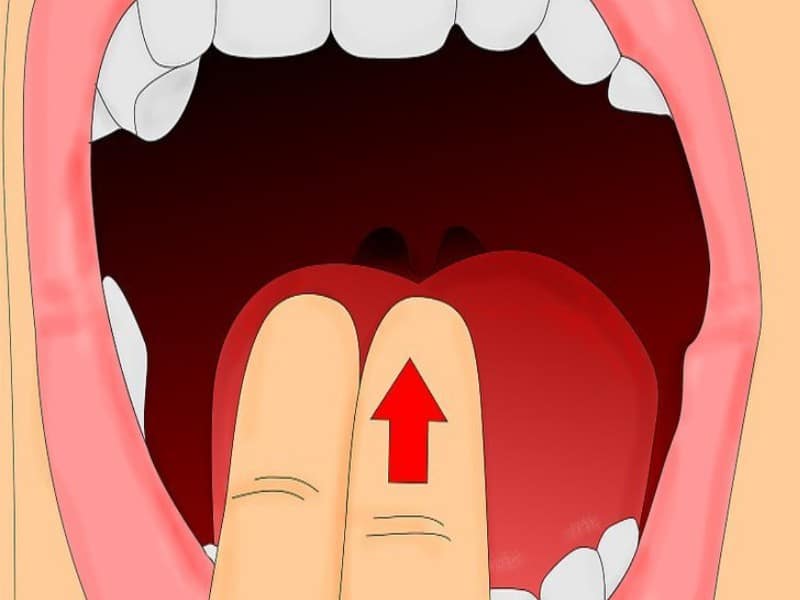 làm sao để nôn hết thức ăn